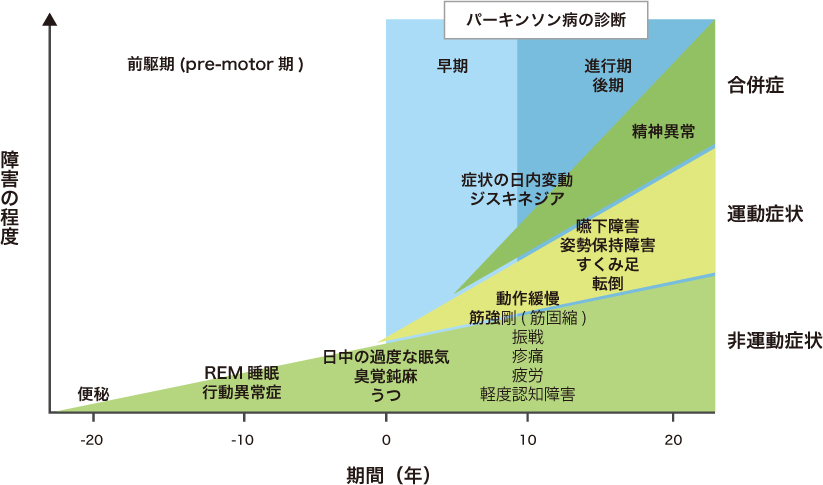末期パーキンソン病の治療選択肢